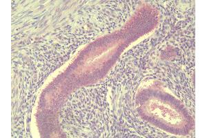 Anti-TSN / Translin antibody IHC staining of human uterus, endometrium. (Translin Antikörper  (C-Term))