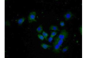Detection of FAPa in Human HepG2 cell using Polyclonal Antibody to Fibroblast Activation Protein Alpha (FAPa) (FAP Antikörper  (AA 542-761))