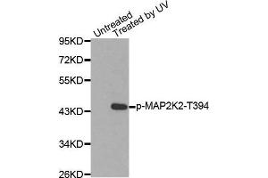 Western blot analysis of extracts from HepG2 cells using Phospho-MAP2K2-T394 antibody.