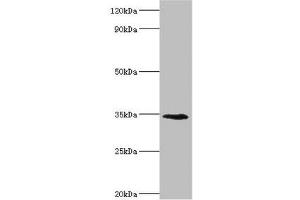 Western blot All lanes: Lymphatic vessel endothelial hyaluronic acid receptor 1 antibody at 8 μg/mL + Mouse liver tissue Secondary Goat polyclonal to rabbit IgG at 1/10000 dilution Predicted band size: 35 kDa Observed band size: 35 kDa (LYVE1 Antikörper  (AA 20-238))