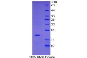 SDS-PAGE analysis of Human Tryptase delta 1 Protein.
