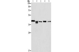 Gel: 10 % SDS-PAGE, Lysate: 40 μg, Lane 1-5: HepG2 cells, mouse kidney tissue, lovo cells, mouse eyes tissue, hela cells, Primary antibody: ABIN7129804(IDH3B Antibody) at dilution 1/233.