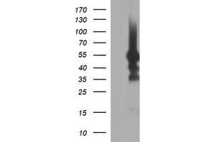 Image no. 1 for anti-Tubulin, beta 1 (TUBB1) antibody (ABIN1501569) (TUBB1 Antikörper)