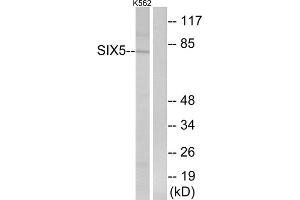 Western blot analysis of extracts from K562 cells, using SIX5 antibody. (Six5 Antikörper  (Internal Region))