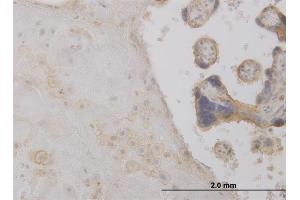 Immunoperoxidase of monoclonal antibody to DCTD on formalin-fixed paraffin-embedded human placenta. (DCMP Deaminase (DCTD) (AA 69-178) Antikörper)