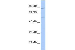 WB Suggested Anti-ZNF585B Antibody Titration:  0. (ZNF585B Antikörper  (N-Term))