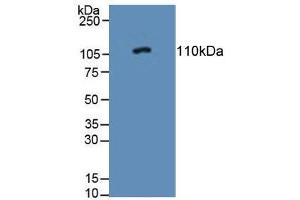 Western blot analysis of Rat Adrenal Gland Tissue. (PTPRN Antikörper  (AA 368-575))