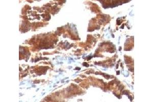 Formalin-fixed, paraffin-embedded human gallbladder stained with TOP1MT antibody (TOP1MT/488). (TOP1MT Antikörper)