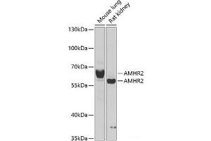 Western blot analysis of extracts of various cell lines using AMHR2 Polyclonal Antibody at dilution of 1:1000. (AMHR2 Antikörper)