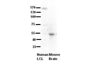 WB Suggested Anti-RRP1 Antibody Titration:  5% Milk  ELISA Titer:  dilution: 1:500  Positive Control:  human LCL and mouse brains