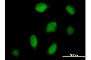 Immunofluorescence of purified MaxPab antibody to CPSF3 on HeLa cell. (CPSF3 Antikörper  (AA 1-684))