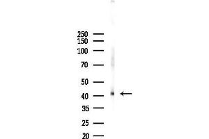 anti-Pyruvate Dehydrogenase (Lipoamide) alpha 2 (PDHa2) (C-Term) antibody