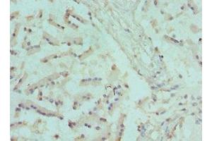 Immunohistochemistry of paraffin-embedded human prostate tissue using ABIN7170062 at dilution of 1:100 (CANT1 Antikörper  (AA 102-401))