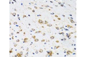 Immunohistochemistry of paraffin-embedded Mouse brain using COPB2 Polyclonal Antibody at dilution of 1:100 (40x lens). (COPB2 Antikörper)