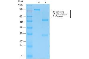 SDS-PAGE Analysis Purified Cytokeratin 15 Rabbit Recombinant Monoclonal Ab (KRT15/2103R). (Rekombinanter KRT15 Antikörper)