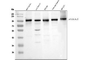 Western blot analysis of FOXK1 using anti-FOXK1 antibody (ABIN7600295). (Foxk1 Antikörper  (AA 175-671))