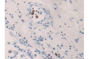 Immunohistochemistry (IHC) image for anti-Killer Cell Immunoglobulin-Like Receptor, Two Domains, Long Cytoplasmic Tail, 3 (KIR2DL3) (AA 22-342) antibody (ABIN1859538)