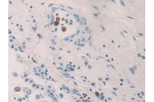 Used in DAB staining on fromalin fixed paraffin- embedded kidney tissue (KIR2DL3 Antikörper  (AA 22-342))