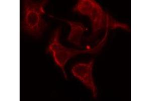 ABIN6274768 staining HepG2 cells by IF/ICC.