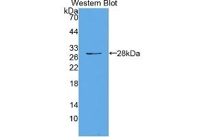 Western blot analysis of the recombinant protein. (HAUS7 Antikörper  (AA 4-319))