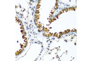 Immunohistochemistry of paraffin-embedded mouse lung using WWTR1 antibody (ABIN5974805) at dilution of 1/200 (40x lens). (WWTR1 Antikörper)