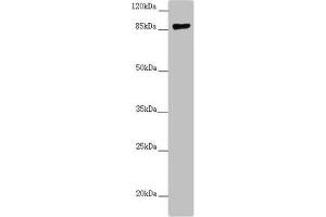 Western blot All lanes: CCHCR1 antibody at 2. (CCHCR1 Antikörper  (AA 483-782))