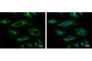 ICC/IF Image Cytokeratin 18 antibody [N2C2], Internal detects Cytokeratin 18 protein at cytoskeleton by immunofluorescent analysis. (Cytokeratin 18 Antikörper)