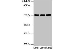 Western blot All lanes: SIGLEC6 antibody at 6 μg/mL Lane 1: Human high value serum Lane 2: A549 whole cell lysate Lane 3: Caco-2 whole cell lysate Secondary Goat polyclonal to rabbit IgG at 1/10000 dilution Predicted band size: 50, 39, 49, 38, 43, 45 kDa Observed band size: 50 kDa (SIGLEC6 Antikörper  (AA 76-269))