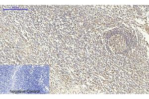 Immunohistochemical analysis of paraffin-embedded human tonsil tissue. (SMAD4 Antikörper  (AA 40-120))