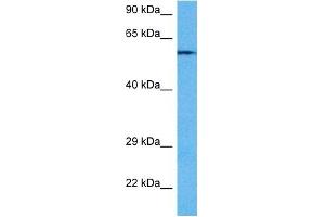 Western Blotting (WB) image for anti-Protein Phosphatase 3, Catalytic Subunit, alpha Isoform (PPP3CA) (N-Term) antibody (ABIN2784523)