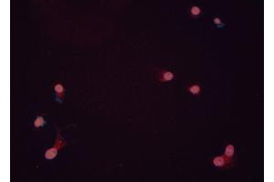 ABIN6276411 staining HEPG2 cells by ICC/IF. (ILK Antikörper  (C-Term))