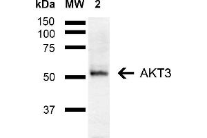 Western blot analysis of Mouse Brain showing detection of ~55 kDa AKT3 protein using Rabbit Anti-AKT3 Polyclonal Antibody (ABIN5667900). (AKT3 Antikörper  (AA 100-200) (PE))