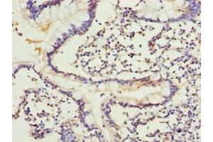 Immunohistochemistry of paraffin-embedded human small intestine tissue using ABIN7143514 at dilution of 1:100 (ARL6IP1 Antikörper  (AA 93-133))