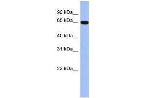 WB Suggested Anti-TRIM47 Antibody Titration:  0. (TRIM47 Antikörper  (Middle Region))