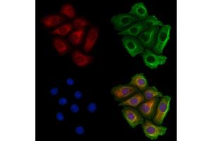 MARS Antibody staining Hela cells by IF/ICC. (Mars (MARS) (Internal Region) Antikörper)