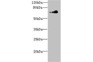 Western blot All lanes: NEK11 antibody at 7 μg/mL + Hela whole cell lysate Secondary Goat polyclonal to rabbit at 1/10000 dilution Predicted band size: 75, 55, 56, 69 kDa Observed band size: 75 kDa (NEK11 Antikörper  (AA 245-482))