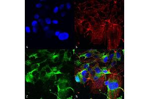 Immunocytochemistry/Immunofluorescence analysis using Mouse Anti-GluA1/GluR1 Monoclonal Antibody, Clone S355-1 (ABIN2485593). (Glutamate Receptor 1 Antikörper  (AA 1-389) (Atto 390))