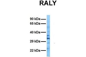 Host:  Rabbit  Target Name:  RALY  Sample Tissue:  Human Ovary Tumor  Antibody Dilution:  1. (Raly Antikörper  (N-Term))