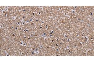 Immunohistochemistry of paraffin-embedded Human brain using MECP2 Polyclonal Antibody at dilution of 1:60 (MECP2 Antikörper)