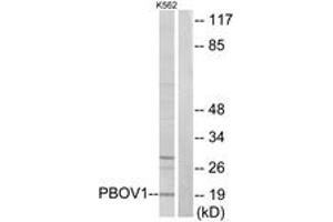 Western blot analysis of extracts from K562 cells, using PBOV1 Antibody. (PBOV1 Antikörper  (AA 31-80))