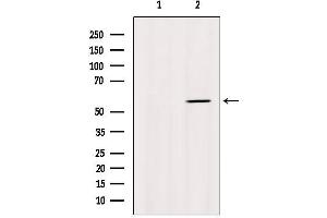 Western blot analysis of extracts from Myeloma cells, using Cytochrome P450 1A2 Antibody. (CYP1A2 Antikörper  (Internal Region))