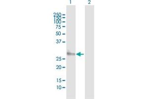 Western Blotting (WB) image for anti-Major Histocompatibility Complex, Class II, DM alpha (HLA-DMA) (AA 1-261) antibody (ABIN516471)