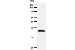Western Blotting (WB) image for anti-Cyclin F (CCNF) antibody (ABIN931023) (Cyclin F Antikörper)