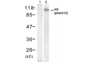 Western blot analysis of extract from DU145 cell, using Androgen Receptor (phospho-Ser213) antibody (E011119). (Androgen Receptor Antikörper  (pSer213))