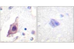 Immunohistochemistry analysis of paraffin-embedded human brain tissue, using CDC25B (Ab-353) Antibody. (CDC25B Antikörper  (AA 319-368))