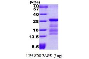 SDS-PAGE (SDS) image for Pituitary Tumor-Transforming 1 (PTTG1) (AA 1-202) protein (His tag) (ABIN666649)