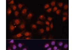 Immunofluorescence analysis of HeLa cells using CDK11B Polyclonal Antibody at dilution of 1:100. (CDK11 Antikörper)