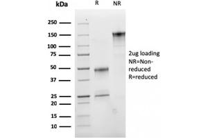 SDS-PAGE (SDS) image for anti-CD47 (CD47) (AA 18-135) antibody (ABIN6941214)