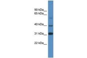 Image no. 1 for anti-SRY (Sex Determining Region Y)-Box 1 (SOX1) (AA 313-362) antibody (ABIN6746081) (SOX1 Antikörper  (AA 313-362))