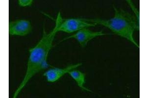 ICC/IF analysis of TPMT in U87MG cells line, stained with DAPI (Blue) for nucleus staining and monoclonal anti-human TPMT antibody (1:100) with goat anti-mouse IgG-Alexa fluor 488 conjugate (Green).